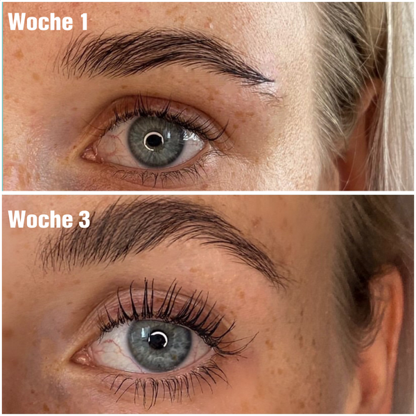 Dr. Massing LongLashes Wimpernserum Serum für lange Wimpern Foto vorher nachher Vergleich